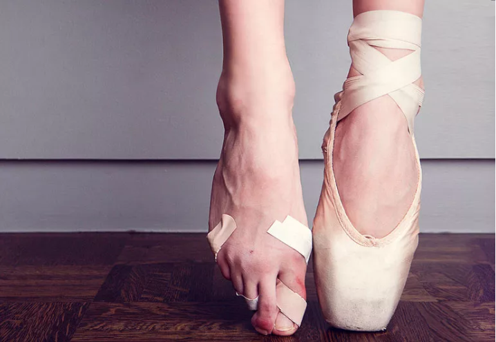 Ballet dancer’s deformed feet due to over working without breaks (Photo by: Cleveland Clinic Health Essentials).